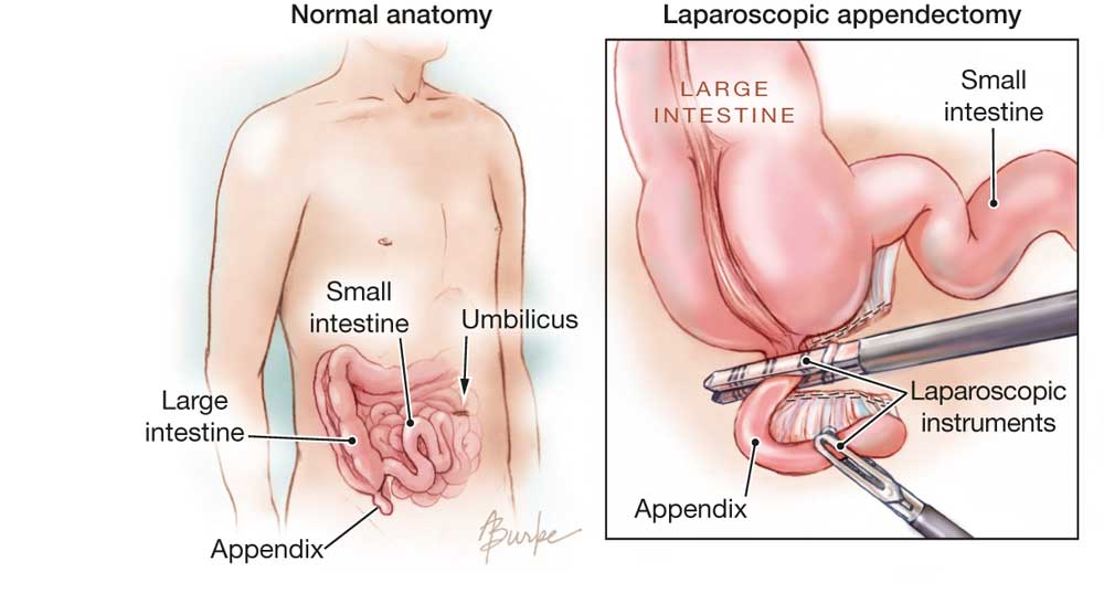 apendix4